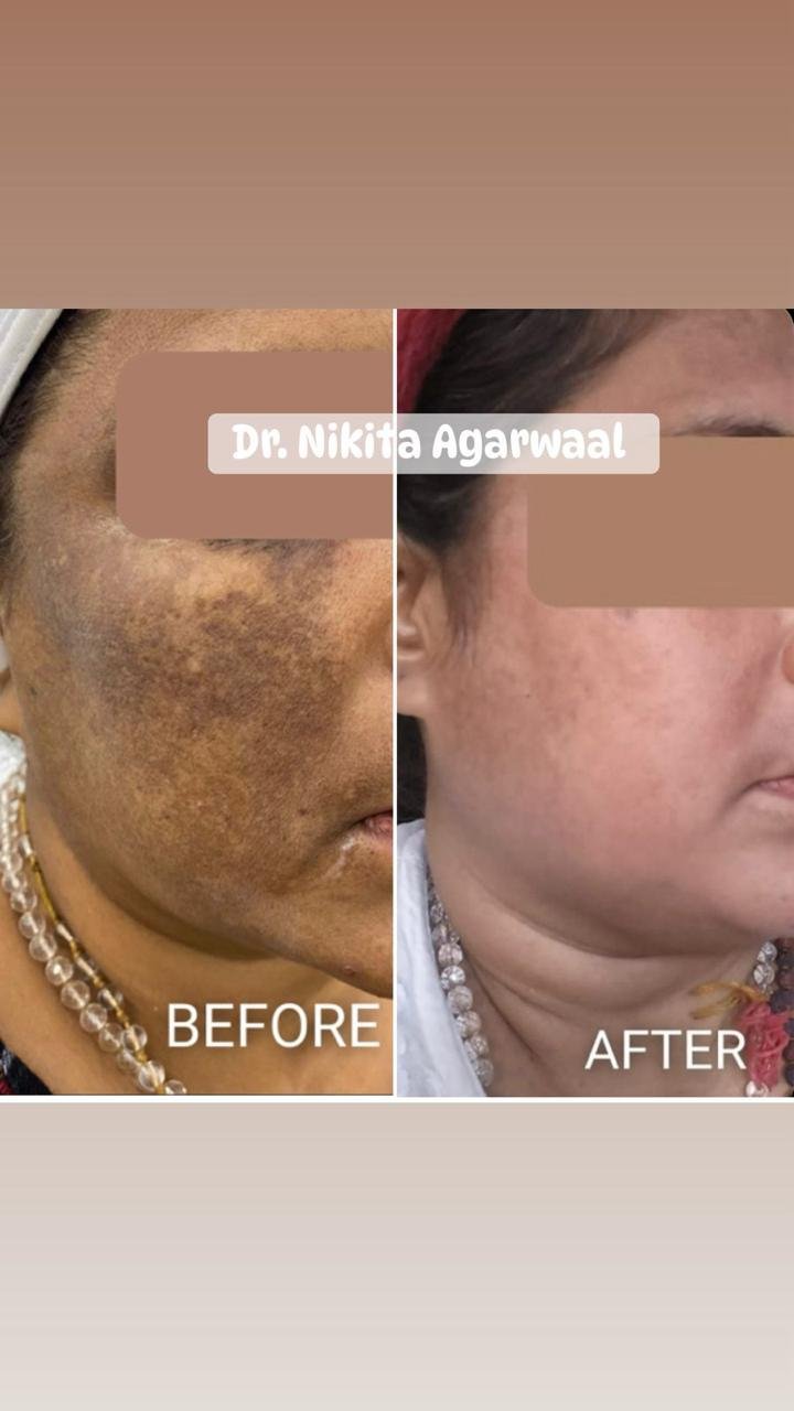 Dermatologist consultation